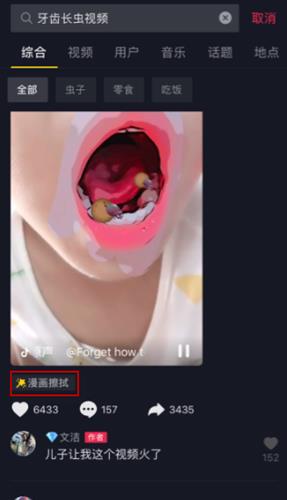 抖音上牙齿有虫子的视频怎么拍_抖音上牙齿有虫子视频拍摄教程